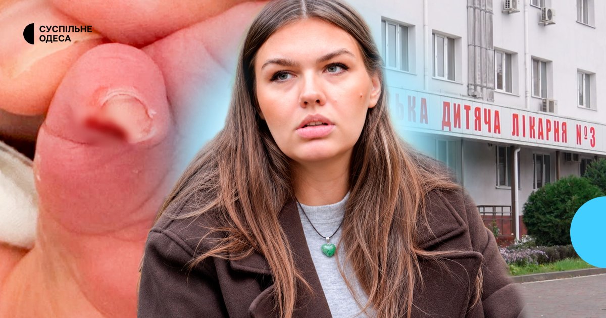 Ви зараз переглядаєте Скандал в одеській лікарні: під час зняття катетера немовляті травмували пальчик